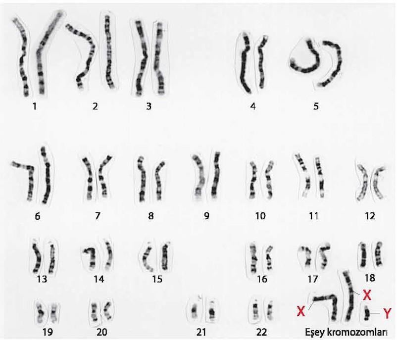 3.1 Klinefelter sendromu (47, XXY) Bireyler genellikle erkektir. Genital organlara ve iç kanallara sahip olmalarına rağmen testisleri körelmiştir.