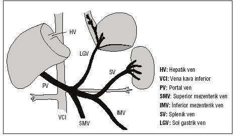 Hepatik ve Portal Portal hipertansiyon genellikle bir -hepatik vasküler bir Portal hipertansiyon nedenleri prehepatik, intrahepatik portal hipertansiyon nedenleri sinüzoidal ve
