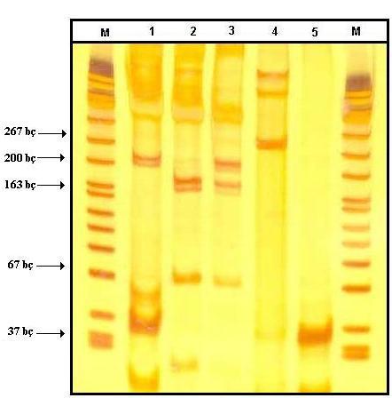 47 Şekil 4.3 : Faktör V Leiden mutasyonunu barındıran gen bölgesi PCR ve kesim ürünlerinin % 12 (29:1) lik poliakrilamit jeldeki görünümleri.