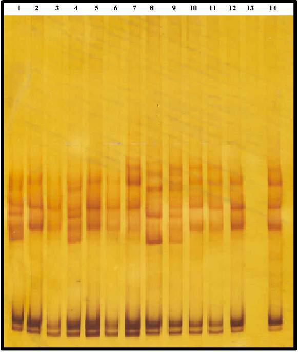 54 Şekil 4.7 : Faktör V Leiden mutasyonunu barındıran ilgili gen bölgesi PCR ürünlerine ait SSCA çalışması.