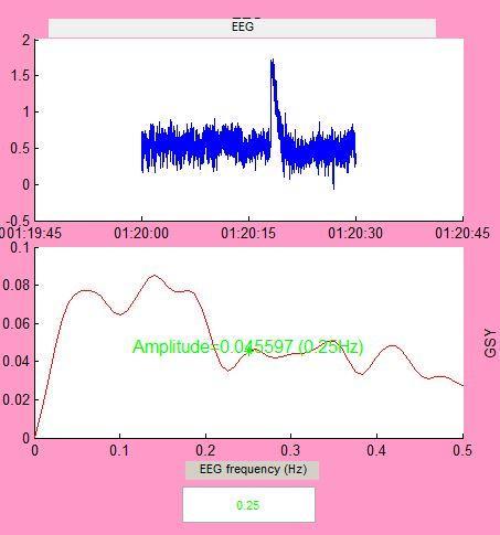 38 Şekil 4.13: Apnesiz durumda işlenmiş EEG Sinyali.