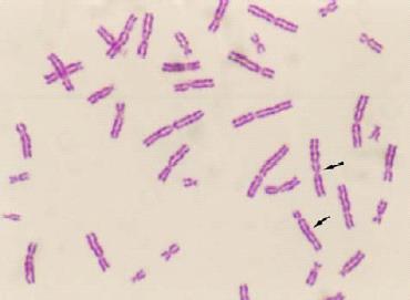 Uygulama 8 : İnsan Kromozom Mikroskobisi Deneyin Amacı: İnsan kromozom karytipinin ışık