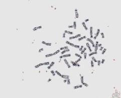hazırlanmış olan insan kromozom mikroskobsi preparatını mikroskoba mikroskoba yerleştiriniz.