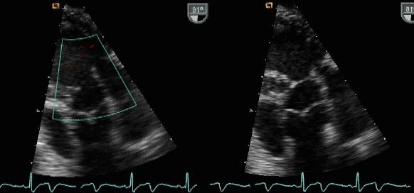 Sürekli EKG Pulse oksimetre İnvaziv arteriyel basınç Santral venöz basınç Kor sıcaklık (mesane, özefagus) İdrar çıkışı Göğüs grafisi İLERİ YÖNTEMLER Beyin BT - Ekokardiyografi Toraks BT Tüm vücut BT