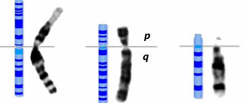 Kromozomlar sentromer pozisyonuna göre farklı isimler alırlar: 1. Metasentrik Kromozomlar: Sentromeri ortada olan kromozomlardır. 2.