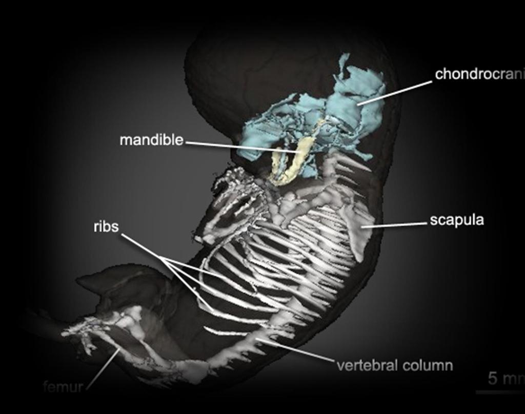 Kondrokraniumun Oluşumu Prenatal dönemde sert