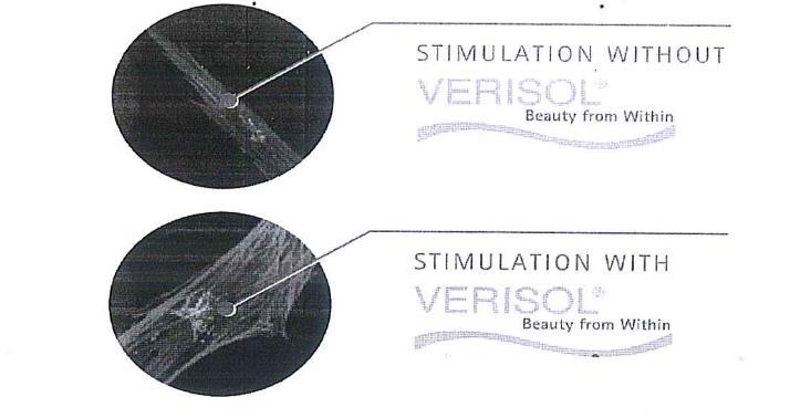 STIMULATION WITHOUT VERISOL - VERISOL SÜZ UYARIM STIMULATION WITH VERISOL - VERISOL LÜ UYARIM Deney Ortamında Kolajen Sentezi Cilt Sağlığında Belirgin İyileşme VERISOL, sağlıklı cildi desteklemek