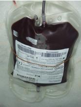 1.2. Eritrosit Süspansiyonları Kan kayıplarında, eksilen kanın karģılanması amacıyla eritrosit süspansiyonları kullanılır. Eritrosit süspansiyonu tam kanın ayrıģtırılması ile elde edilir.