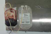 Santrifüj edilen tam kan torbaları, santrifüjden alınır. Tam kan torbaları, ekstraktöre yerleģtirilir. Ekstraktörde test programı seçilir. Ekstraktörde tam kan torbasının klempleri kırılır.