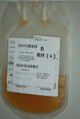 Elde edilen random trombositin üzerine uygunluk etiketi (hazırlandığı kan merkezi, bağıģ tarihi, ünite numarası, kan