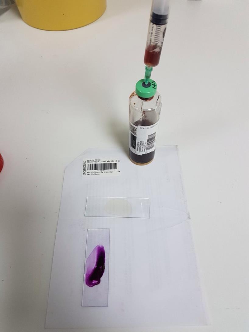 Olay yeri: Mikrobiyoloji laboratuvarı Kan kültür cihazı sinyal verir (saat 9:00) Pozitif şişe cihazdan