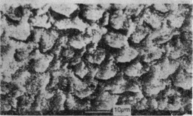 Cilt 12, Sayı 2 AKÖREN, YURDUKORU Dişler, 200 A kalınlığında altın ile kaplandıktan sonra, SEM incelemeleri Çimento Müstahsilleri Birliği'nde tarama elektron mikroskobunda yapıldı.
