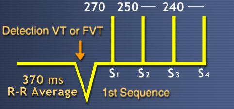 ATP Ramp + l Burst tedavisini farklı programlanabilen intervallerde 2 uyarı takip eder l Her defasında pacing uyarısı