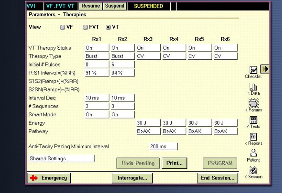 ICD Programlama