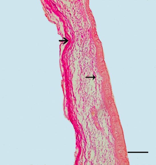 Elastik fibriller Sirinksin trakeyal kısmında epitel altından bağ dokusunun derinlerine doğru dağınık şekilde yerleşim gösteren