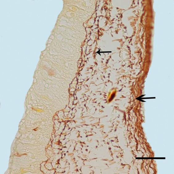 Pessulusun uç kısmına ait epitel altında dar bir alanda ince demetler halinde yerleşim gösteren retikulum fibrillerinin pessulus lateralinde geniş bir alanda sıkı biçimde