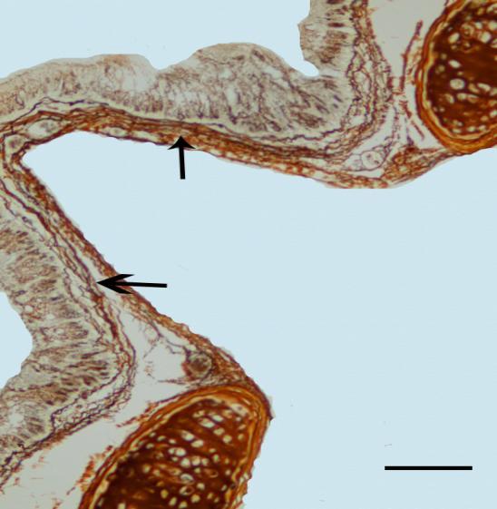 Retikulum fibrillerinin MTM a ait epitel altında geniş bir alanda ince demetler halinde bulundukları; bağ doku derinlerine doğru giderek sıkılaşıp kalınlaştığı ve kalın demetler
