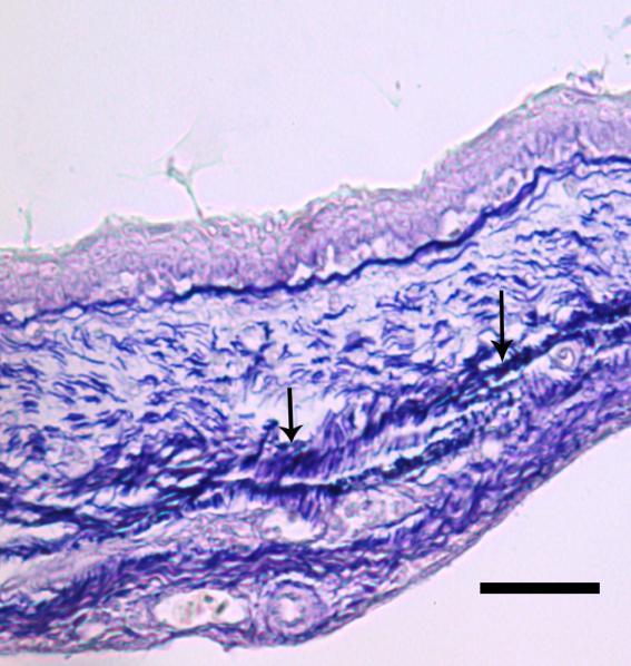 MTM a ait epitel altında kollagen fibrillere nazaran daha geniş bir alanda kalın fibriller