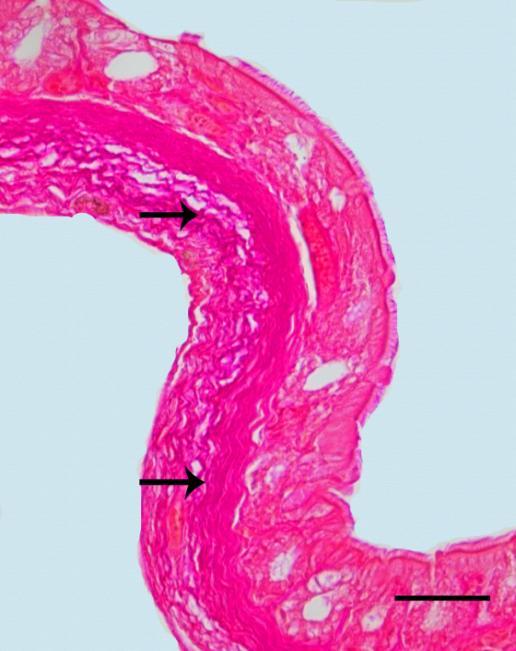 Elastik fibril Trakeyal kısma ait epitelin hemen altında ve trakeyal kıkırdak halkalar