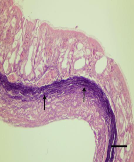 Pessulusun uç kısmına ait epitel altında ince fibrilsel tarzda yerleşim gösteren elastik fibrillerin pessulus lateraline doğru sıkı biçimde düzenlendikleri ve yoğunluklarının arttığı 