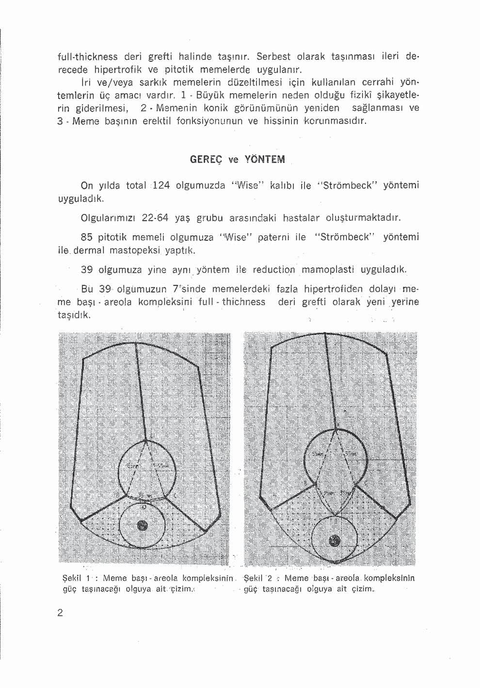 full-thickness deri grefti halinde taşınır. Serbest olarak taşınması ileri derecede hipertrofik ve pitotik memelerde uygulanır.