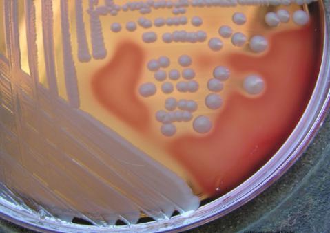 Serbest koagülaz ve bağlı koagülaz olmak üzere iki türü vardır. Koagülaz testi, Staphylococcus aureus un diğer stafilokoklardan ayırt edilmesinde kullanılan en önemli testtir.