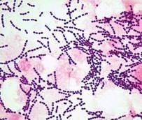 Streptococcus (Streptokoklar) Morfolojisi Streptokoklar hareketsiz, sporsuz, gram pozitif [ gram (+) ] bakterilerdir. Tek tek kok veya diplokokların yan yana gelmesi ile oluģur.