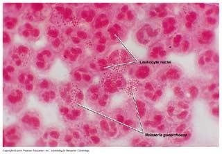 Neisseriae gonorrhoaea (Gonokok) Morfolojisi Neisseriae gonorrhoaea, hareketsiz, sporsuz, gram boyasını almayan yani, gram (-) bakteridir.