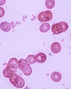 2.4. Haemophil (Hemofil) Bakteriler Bu grupta hareketsiz, sporsuz, küçük, koko-basil özelliğinde, gram (-) bakteriler vardır.