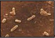 2.5.4. Bordetella Pertussis Morfolojisi Bordetella pertussis; hareketsiz, sporsuz, gram (-), özel boyalarla gösterilebilen kapsülleri olan küçük koko-basildir. Üreme Özellikleri Resim 2.