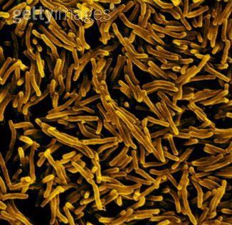 Gliserinli buyyonda; Mycobacterium tuberculosis bovis çok yavaģ ürer. Önemli bir özelliği de mikroaerofil olmasıdır.