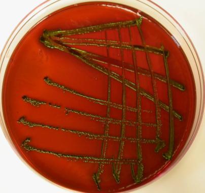 coli kolonileri genelde dıģkı kokusu verir. Laktoz (+) dir. E.