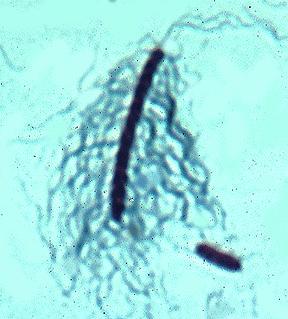 Laboratuvar TeĢhisi Escherichia coli de olduğu gibidir. 2.8.3.