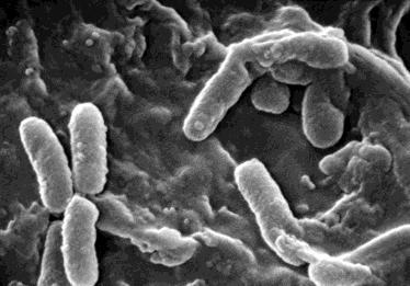 Yaptığı Hastalıklar Klebsiella pneumoniae; bulunduğu yerlerde uygun koģulların oluģması veya yer değiģtirerek diğer organ ve sistemlere yerleģmeleri halinde, baģta pnömoni olmak üzere, anjin,