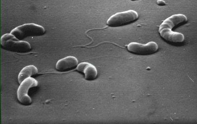 2.10. Vibrio Cholerae Vibrio cholerae nın insanlarda hastalık yapan iki türü vardır. En patojen tür Vibrio cholerae dır. Patojen olan diğer tür ise Vibrio cholerae eltor dur.