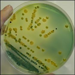 Antijenik Özellikleri Resim 2.51: Vibrio cholerae Vibrio cholerae nın O ve H antijenleri vardır. O antijenleri vibriobiotipleri arasında farklılık gösterir.