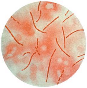 Üreme Özellikleri Vibrio cholerae ya benzese de bazı farklar vardır. Bunlar; Vibrio cholerae eltor, dıģ Ģartlara daha çok dirençlidir. Vibrio cholerae salgınları birden bire çıkar.