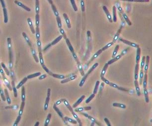 Bacillus Subtilis Bacillus subtilis hastalığa neden olmayan, gram (+), aerob, saprofit bir basildir; insanlar,