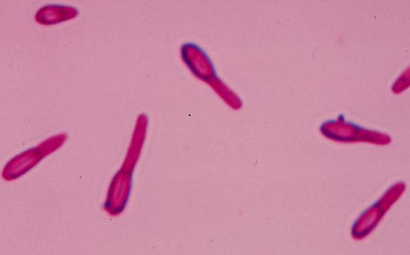 Biyokimyasal testler; glikoz fermantasyonu, metil kırmızı ve voges- proskauer testleri yapılır. 2.11.2. Gram (+) Anaerob Sporlu Basiller (Clostridiumlar) Tabiatta çok yaygındır.