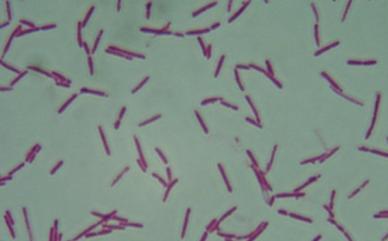 Clostridium septicum hariç diğer ikisi hareketsiz; Clostridium perfringes hariç diğer ikisi kapsülsüz