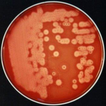 62: Clostridium novyi Gazlı gangren etkeni clostridiumlar, zorunlu anaerobtur.