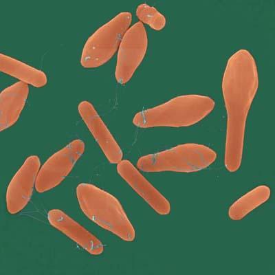 Antijenik Özellikleri Clostridium septicum um O ve H antijeni vardır. Clostridium perfringes ve Clostridium novyi iyi antijenik özellik göstermez.