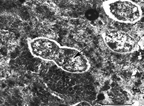 Şekil 2. İkiye bölünerek çoğalan bir Wolbachia görüntüsü (Skala bar=0.5 μm) (Kozek, 2005) Üreme sistemlerinde yaşayan bakteri bir konukçudan diğerine yumurta sitoplazması yolu ile taşınmaktadır.