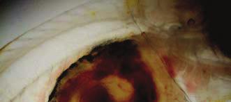 Pankreas, sb: Hava kesesi, o: Operkulum, e: Göz, E: Beyin, *: Mesane (Santamaria et al., 2004).