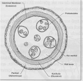 HİDATİK KİSTİN YAPISI Üçtabakadan oluşur I. Perikist (advenwsya): Parazite ait değildir. Konağın kist etratnda oluşturduğu fibröz kapsüldür. II. Ekzokist (KuWkula, laminer membran) Kis?