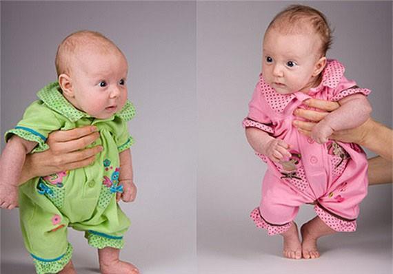 Dizigotik ikizler İki ayrı döllenme olayı sonucuna meydana gelen ikizlerdir. Ayrı yumurta ikizleri olarak da bilinirler.