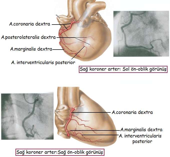Koroner anjiografide anatomik yapı Resim 1.