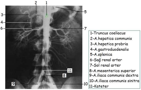 Aorta abdominalisin dıģ yan yüzlerinden çift olarak a.renalis, a.suprarenalis media ve a.testicularis veya ovarica çıkar. A.renalis: L1-2 düzeyinden çıkar.