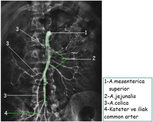 arteriogram, A-P 27: