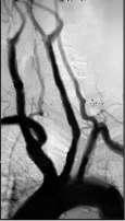 Aort kemerinden ayrılan arterleri radyogramda gösteriniz.